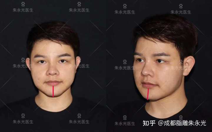 我想知道脸太方了怎么办呀? - 知乎