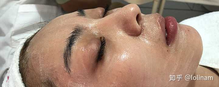 美容院所谓的祛痘有用吗 知乎 美容院所谓的祛痘有用吗 知乎