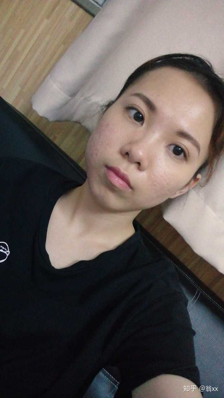 拔完智齿脸为什么会肿 知乎