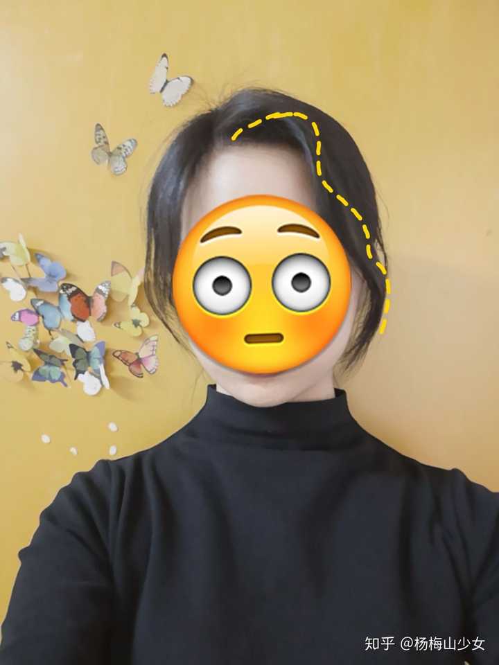 窄额头发际线低可能真的没未来吧,微笑jpg?