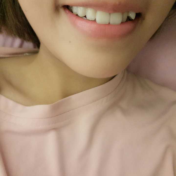 都说露八颗牙好看,可是如果有虎牙怎么笑?