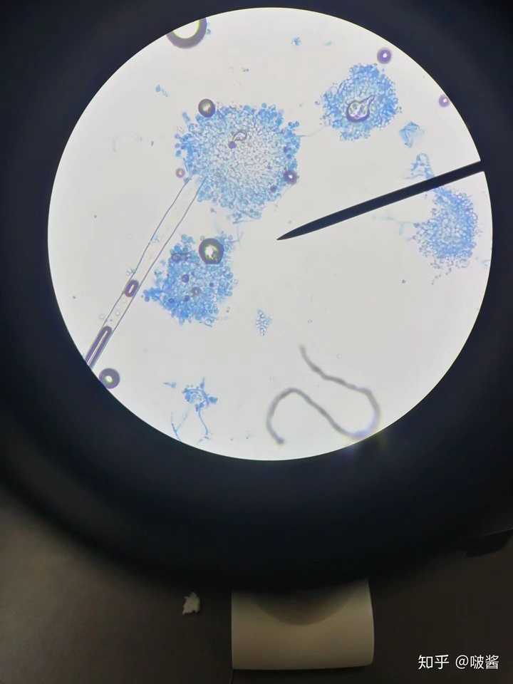 黄曲霉显微镜图片图片