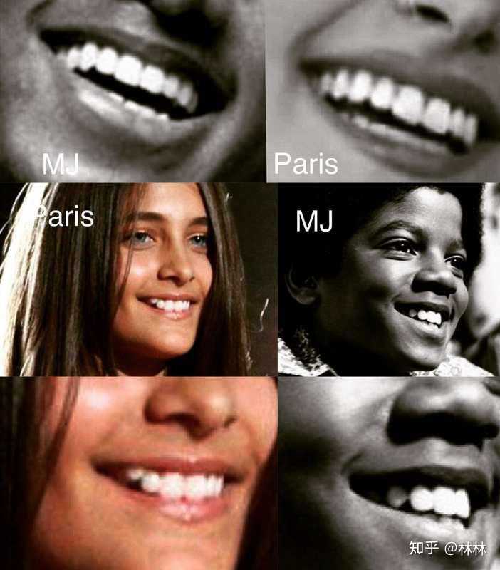 黑人的身份让迈克尔·杰克逊遭受了多少苦难?