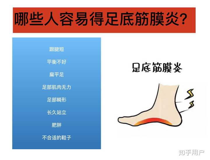 跑步两脚内侧肌肉感觉疼 鞋没有问题 换过好几双 怎么才能缓解 知乎 跑步两脚内侧肌肉感觉疼 鞋没有问题 换过好几双 怎么才能缓解 知乎