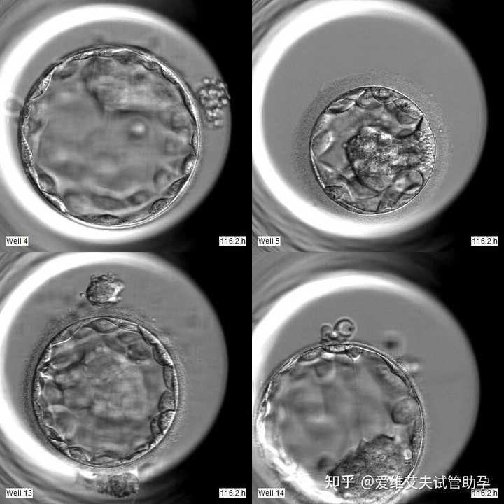 为什么那么多的人选择囊胚移植? - 知乎
