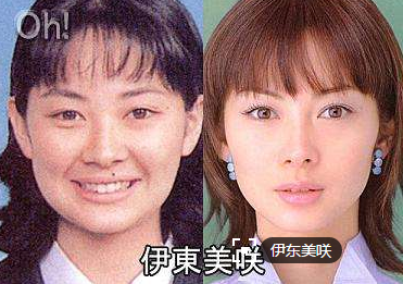 听说日本也有很多女星整容 为什么看起来日本女星整容比韩国的自然很多 但是好像国内很少有人去日本整容 知乎 听说日本也有很多女星整容 为什么看起来日本女星整容比韩国的自然很多 但是好像国内很少有人去日本整容 知乎