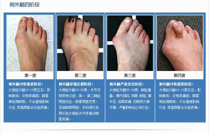 知道自己有先天性身体缺陷是种什么样的体验?