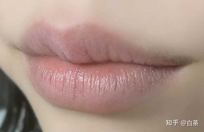 如何去除嘴角的黑色素 知乎 如何去除嘴角的黑色素 知乎