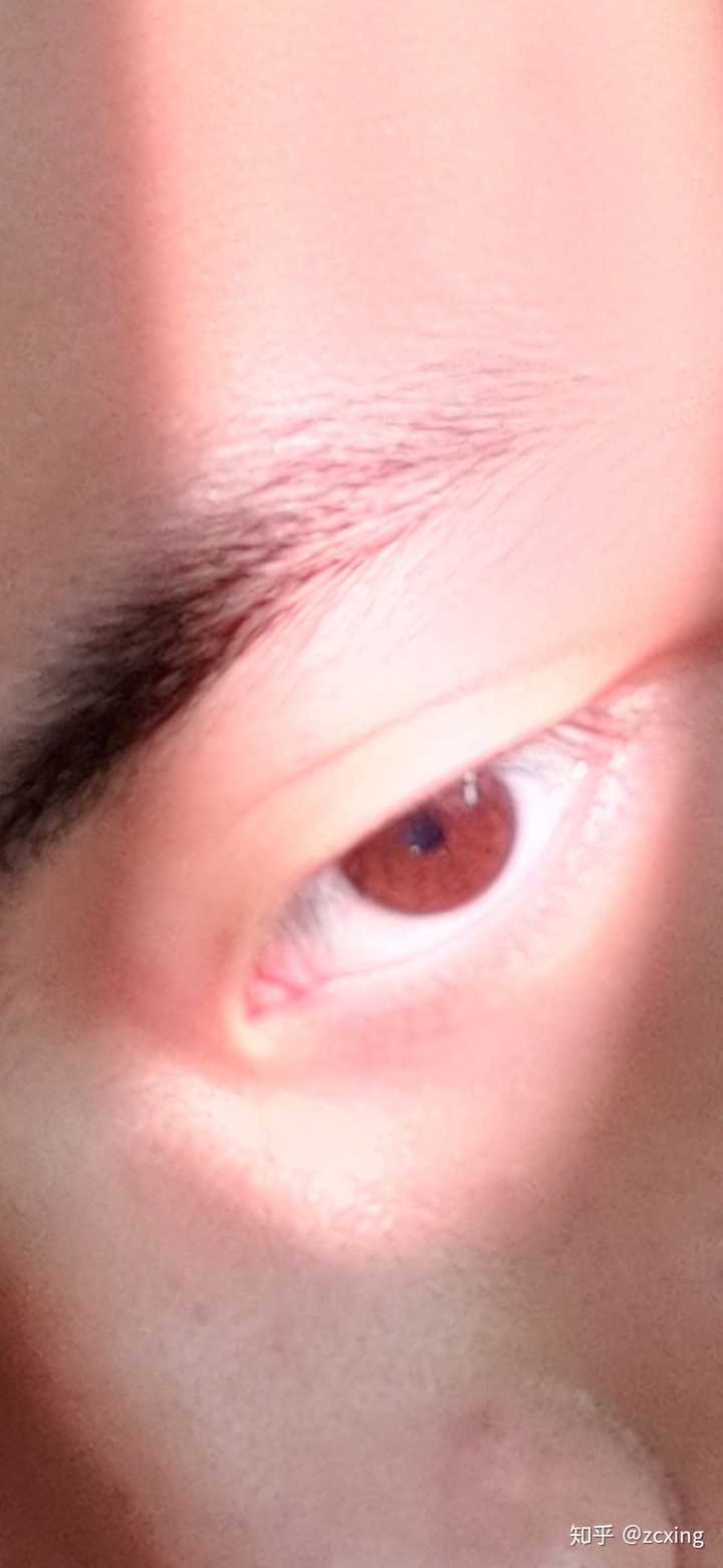 为什么有些中国人的眼睛是棕黄色的?