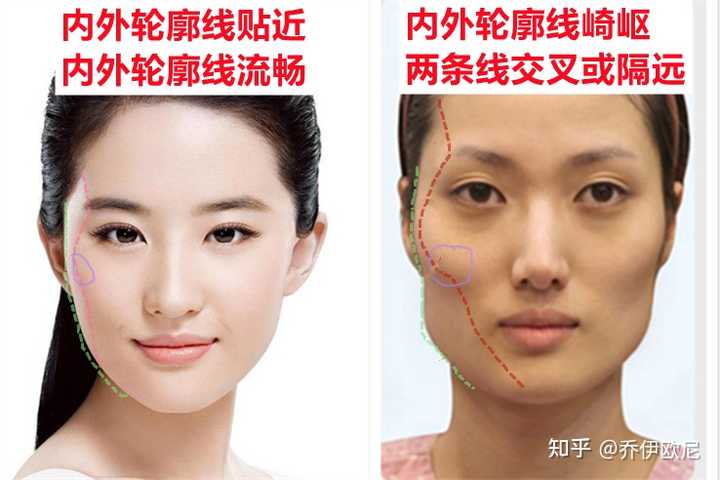 怎么判断自己的颧骨是高还是外扩，还是假性颧骨高？ - 知乎