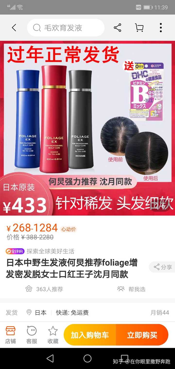 有没有亲测特别有效的生发方法 知乎