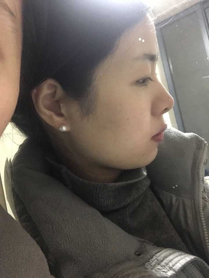 脸大而且颧骨宽下巴短是种什么体验,哭唧唧?