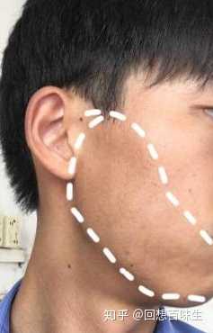 怎样才可以减少黑色素沉淀……?