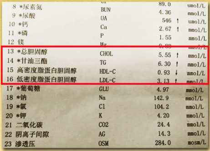 有哪些方式可以有效降血脂 知乎 有哪些方式可以有效降血脂 知乎