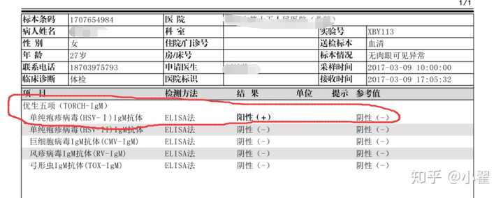 孕後torch檢查,單純性皰疹病毒igg,igm均偏高,胎兒能要嗎?