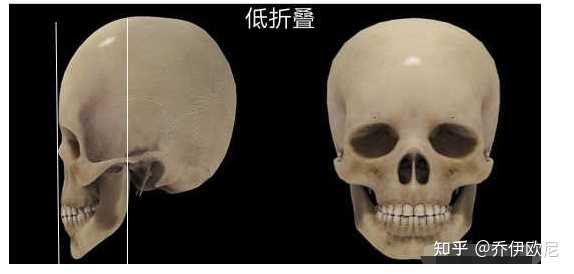 怎么判断自己的颧骨是高还是外扩，还是假性颧骨高？ - 知乎