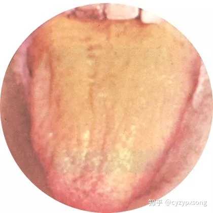 如何学好中医诊断学?