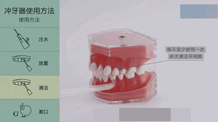 冲牙器怎么用好?