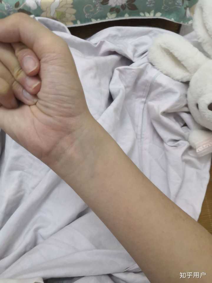 你见过最细的手腕是多细?