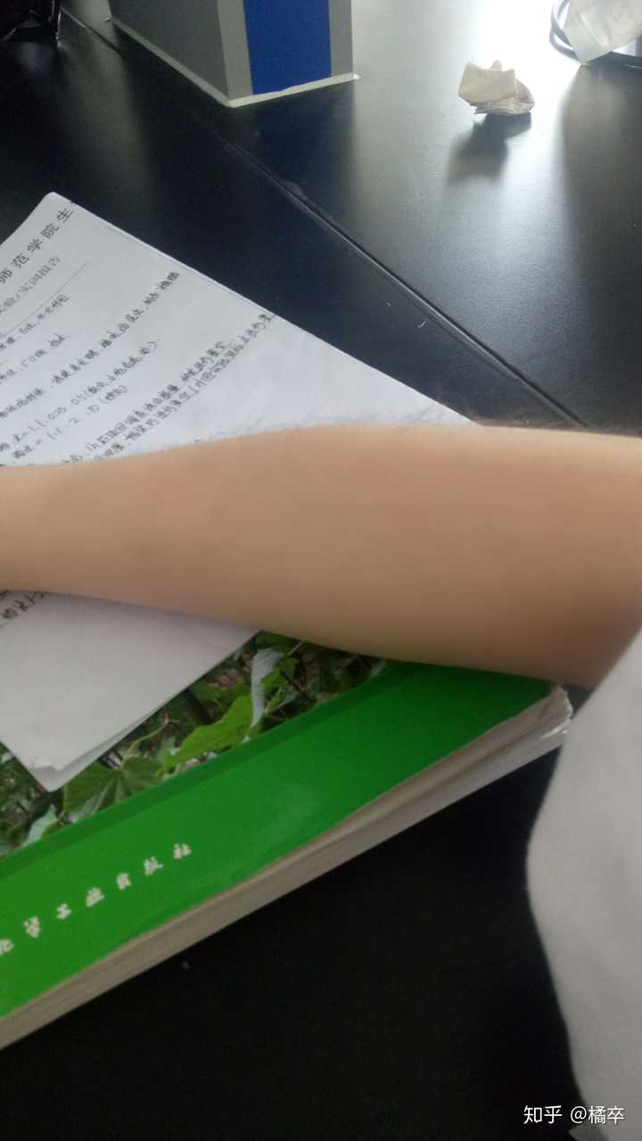 女生可是手臂上汗毛长又多,夏天怎么办好? - 知乎