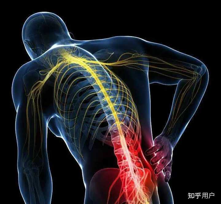 弯腰腰疼怎么解决呢? - 知乎