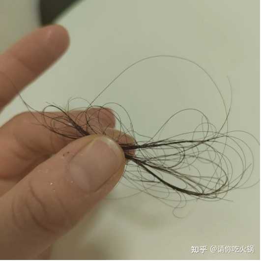 怎么让头发变多? - 知乎