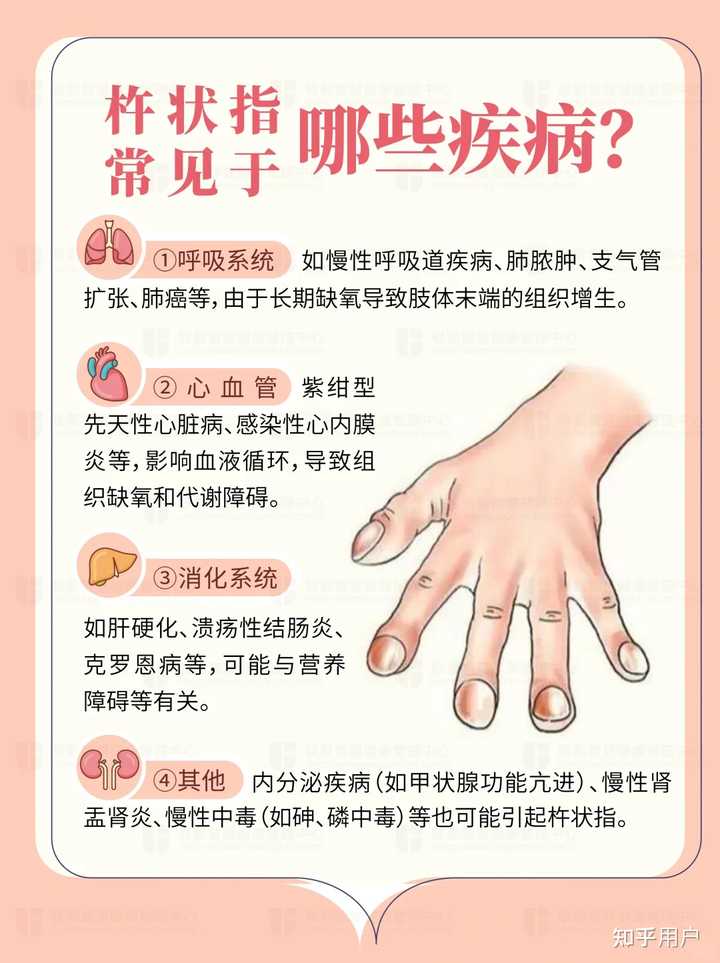 杵状指常见于哪些疾病? - 知乎