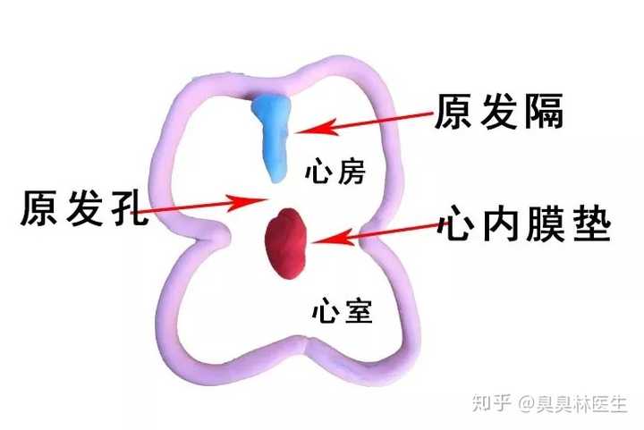 有先天性心脏病是一种什么样的感受 知乎