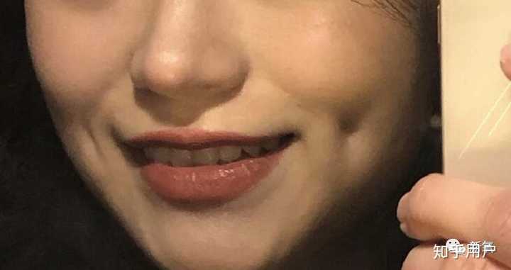 酒窝可以后天形成吗? - 知乎