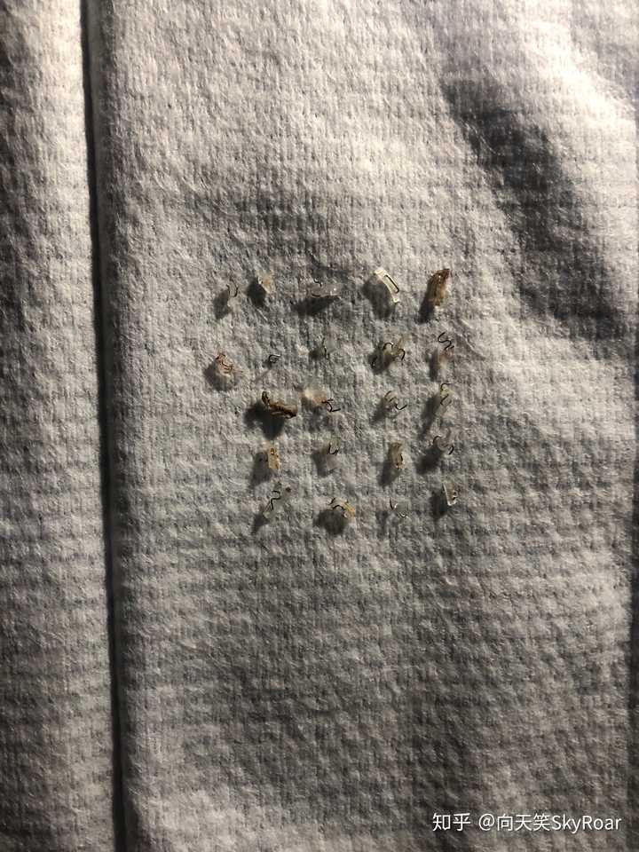 60 人赞同了该回答 十五天全部掉完,基本全是手动脱落,没有什么钉子是