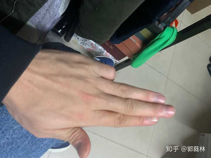 吉他左手小拇指指尖往无名指上靠，按弦的时候没法垂直，能纠正吗？
