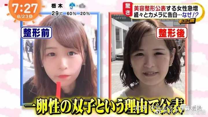 如何去日本整容 知乎
