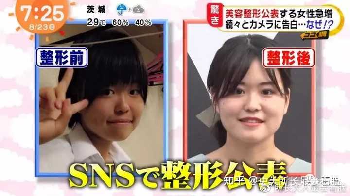 如何去日本整容 知乎