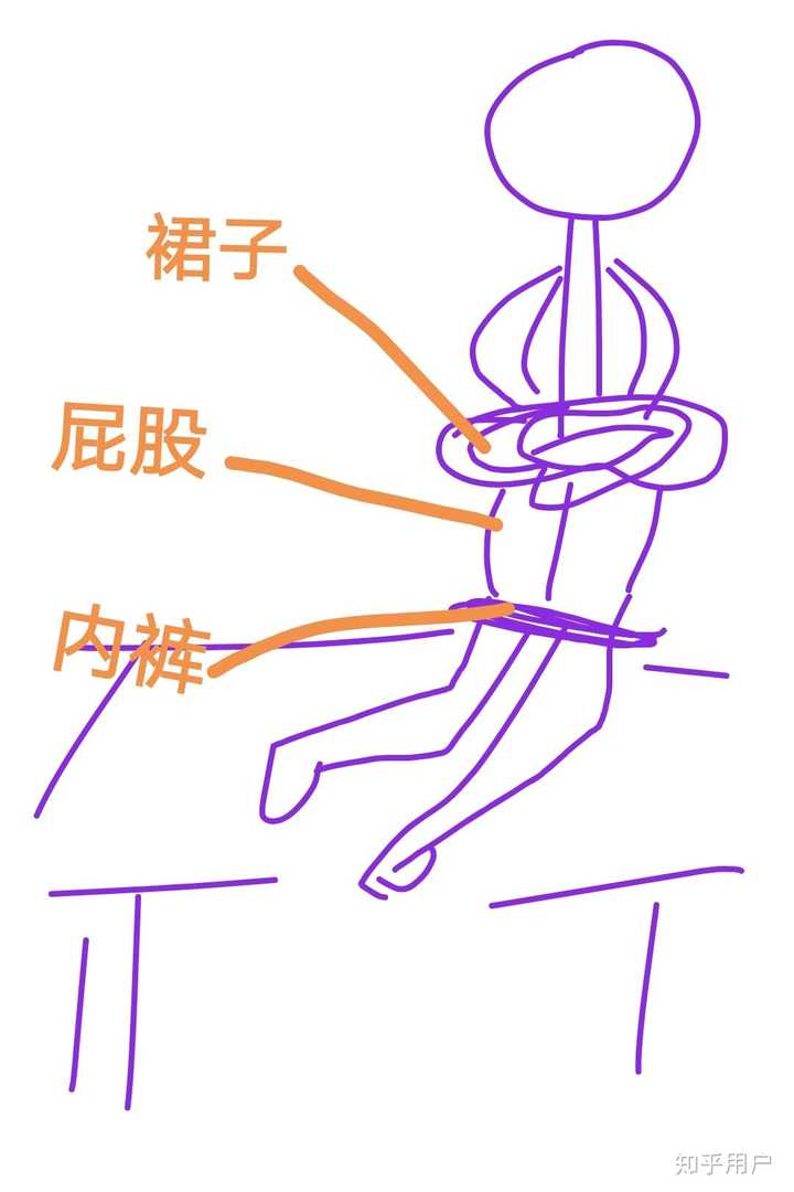 还不好意思撅屁股,露出菊花,大夫过来看了看我说,躺下. 躺下?