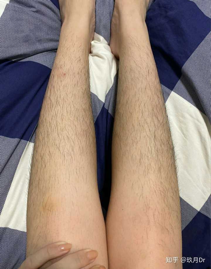 我是女生学生党请问一下如何有效脱毛 特别是腿毛 在此先谢过各路大神呜呜呜 知乎 我是女生学生党请问一下如何有效脱毛 特别是腿毛 在此先谢过各路大神呜呜呜 知乎