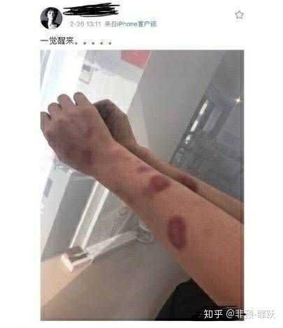 如何看待黄景瑜前女友王雨馨自杀未遂 助理发文斥责男方一事 发生了什么 知乎