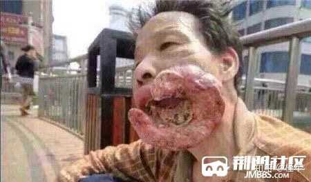 如何看待人大代表关于警示图形上烟盒的建议