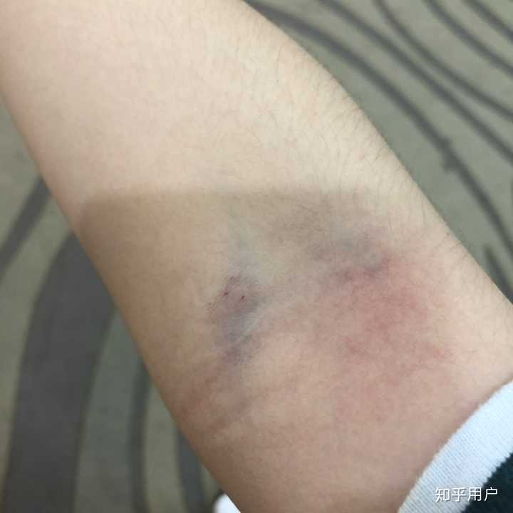 。感觉他们有些人很不专业，抽血的时候居然扎了我两个孔，我疼了好久。
