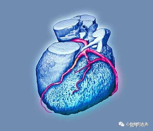 冠状动脉 CT 血管造影检查可预防心梗或猝死发生,冠状动脉 CT 与造影有什么区别? - 知乎