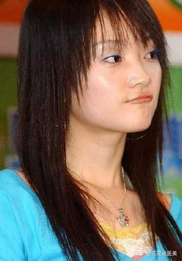 为什么整容一眼就能看出来?