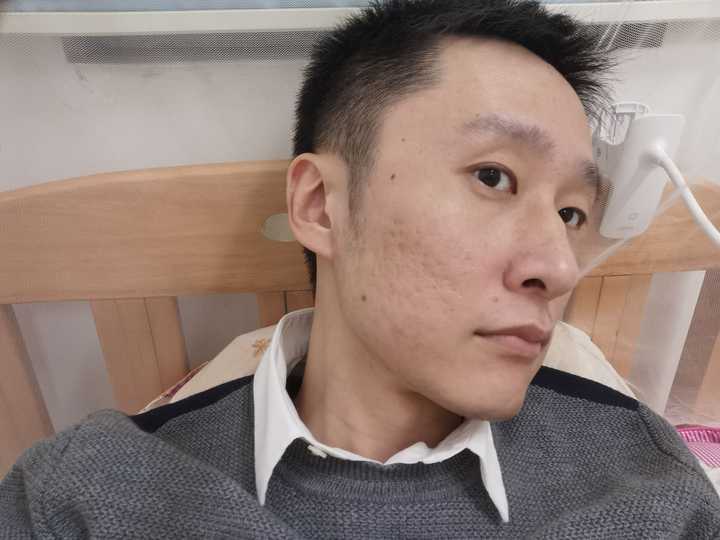 我目前的皮肤状态表示还可以,给我开了外用的氯霉素和复方黄柏液涂剂