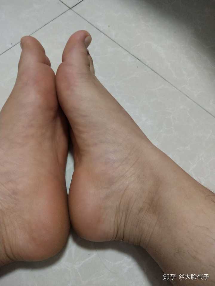 女生脚丑是种什么样的体验?