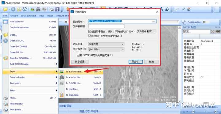 DCM文件怎么打开？ - 知乎