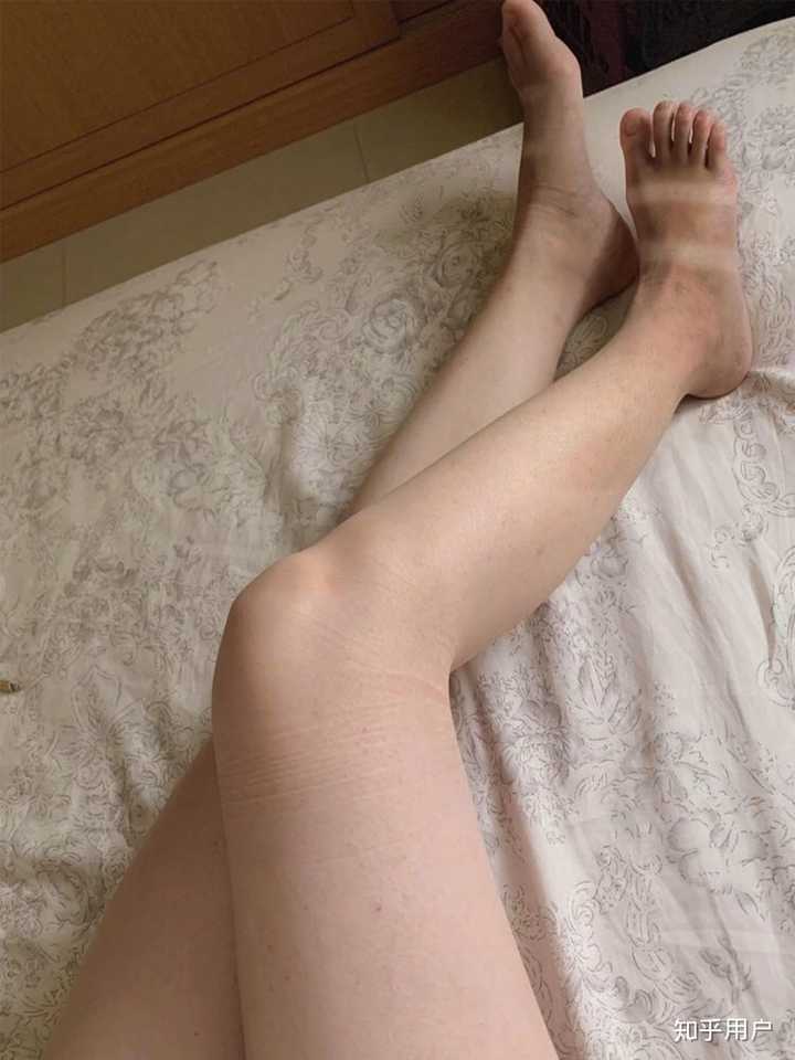 脚晒黑了怎么恢复 知乎