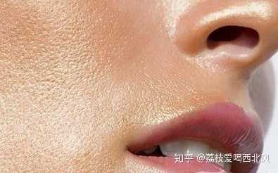 而油皮的日常护肤,即清洁—保湿—防晒,都要讲究一个适度.