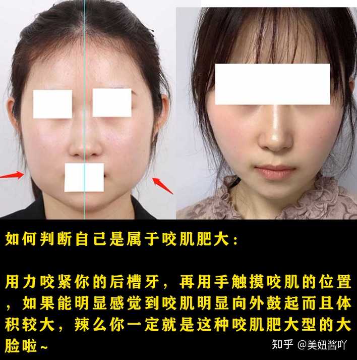 有哪些整容 微整特别成功的明星 知乎