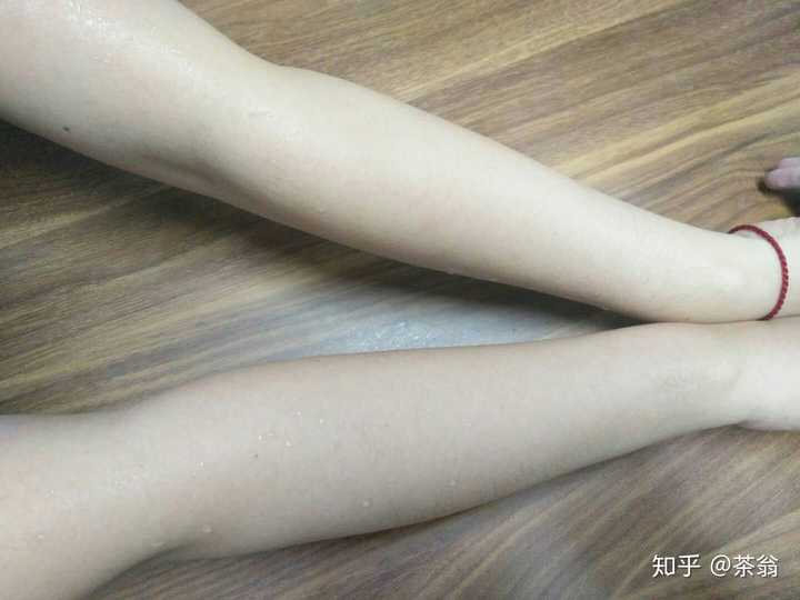体毛多是什么原因造成的？ - 知乎