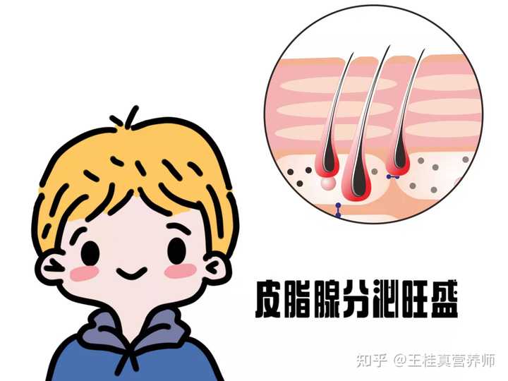 2男性皮脂腺分泌多男人的代谢比较旺盛，洗脸的时候甚至能够在水里看到油
