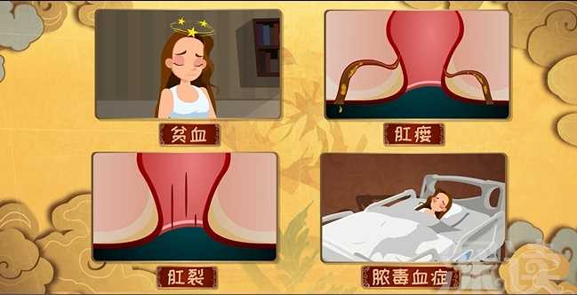 痔疮怎么引起的啊 知乎