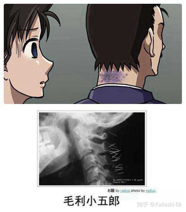 如果你是毛利小五郎,会不会相信自己有沉睡推理秀的能力?